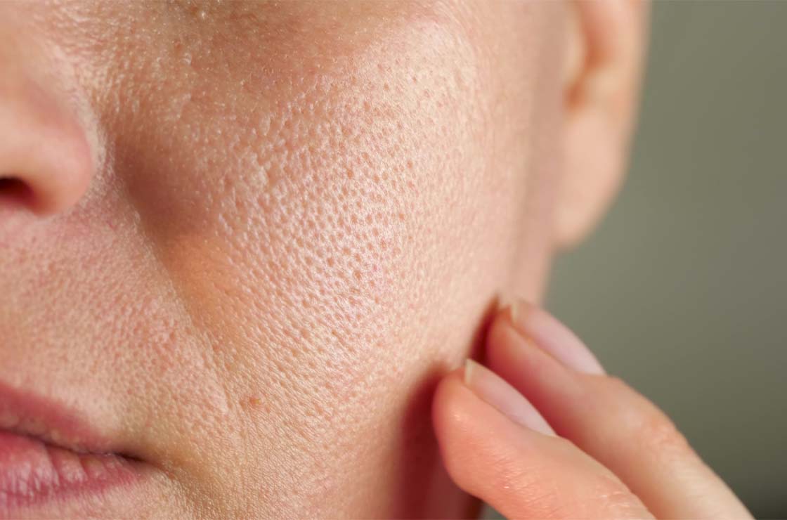 Gros plan d'une peau granuleuse sur l'avant-bras, texture rugueuse et relief irrégulier