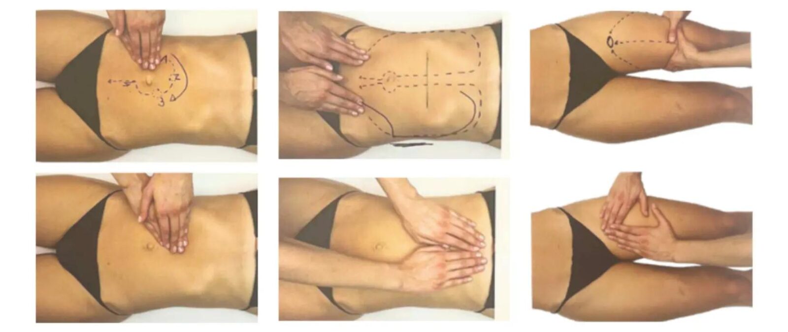 Résultat avant après d'un drainage lymphatique sur le ventre et les jambes